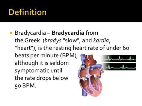 words that are similar to brachycardia